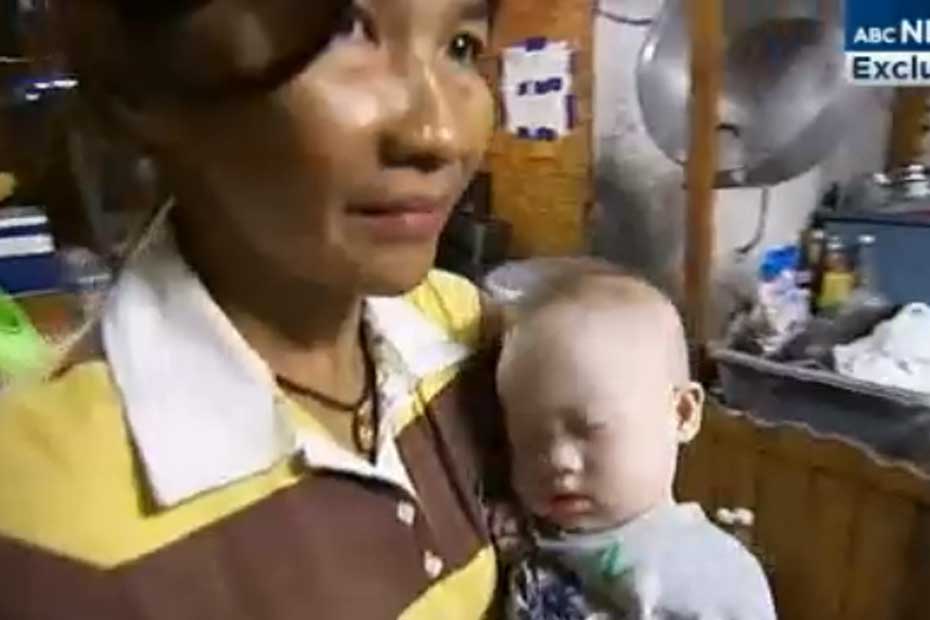 Le Bebe Trisomique Abandonne A Sa Mere Porteuse Va Mieux Petit A Petit