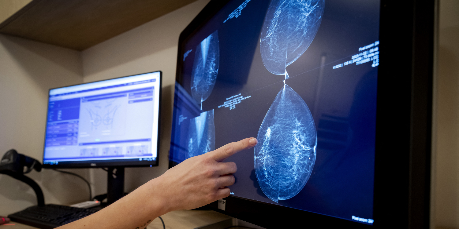 Comment un pourrait détecter le cancer du sein d'ici — free download