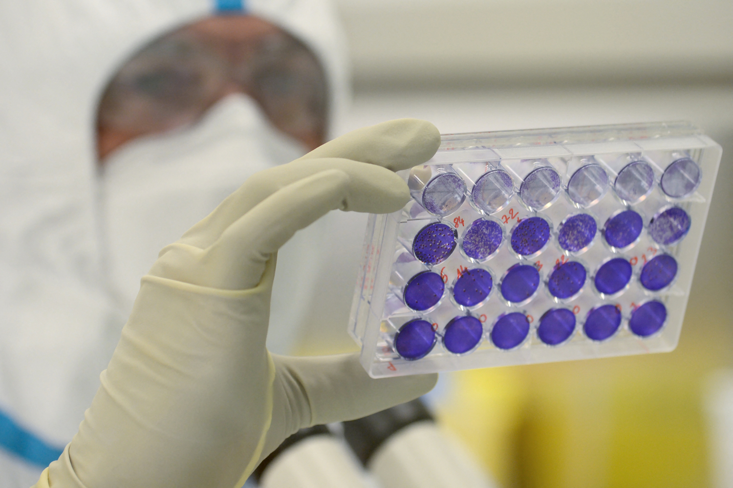 Le Gouvernement Britannique Admet Que Le Vaccin