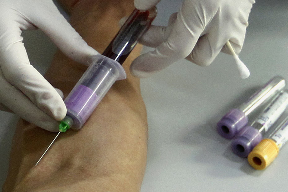 Un test sanguin pour détecter le cancer