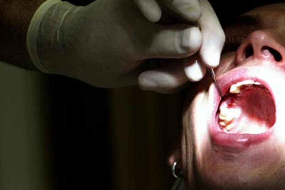 Dentistes Ripoux C Etait Systematique