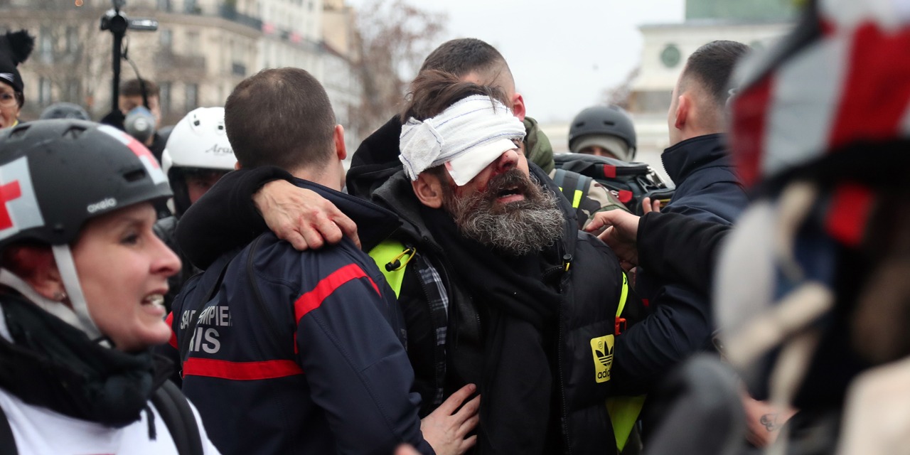 Le Gilet Jaune Jérôme Rodrigues Blessé à Lœil Un