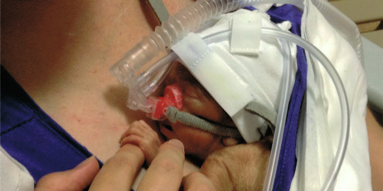 Une Photo Choc Avec Un Grand Premature Envoyee Aux Deputes